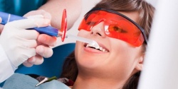 Художественная и эстетическая реставрация зубов